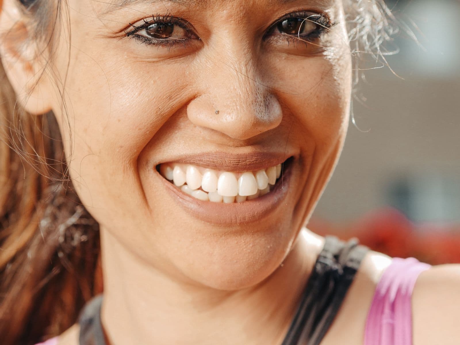 A patient with a bright, confident smile after cosmetic treatment