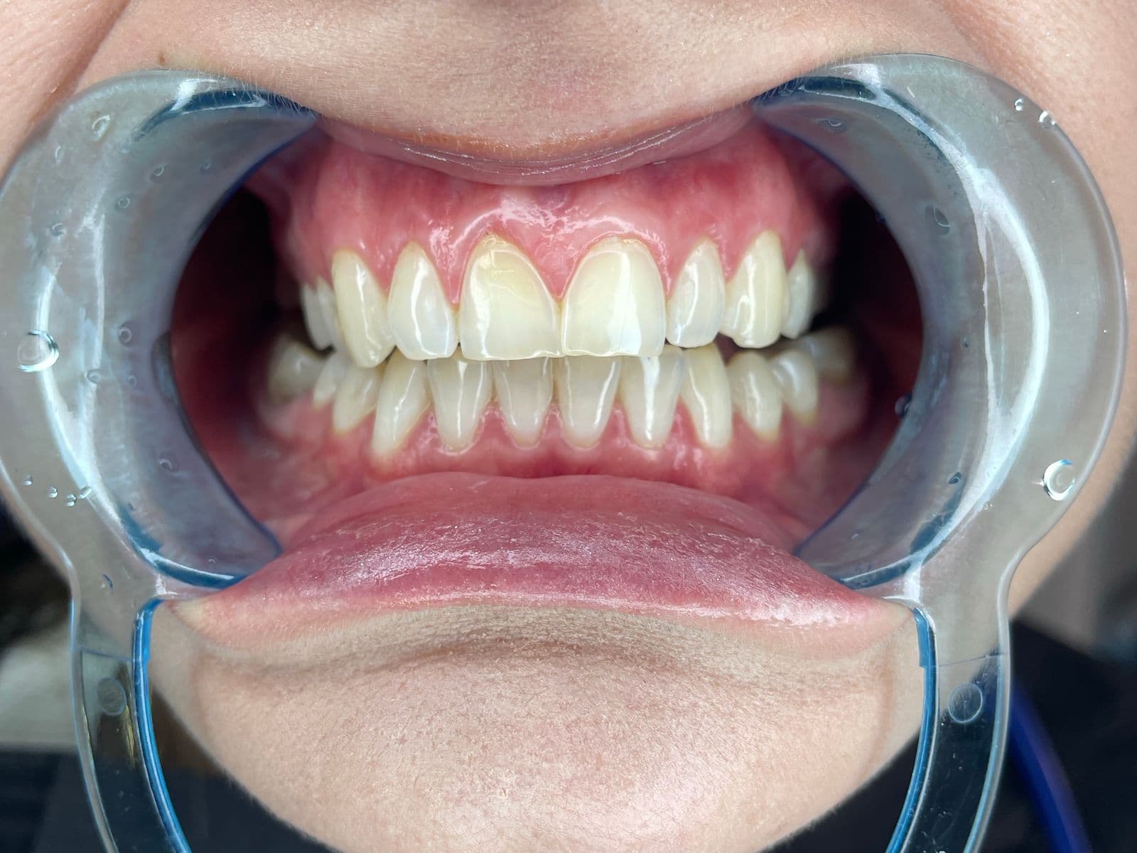 Careful, gentle dental treatment at Fairfield Dental Centre